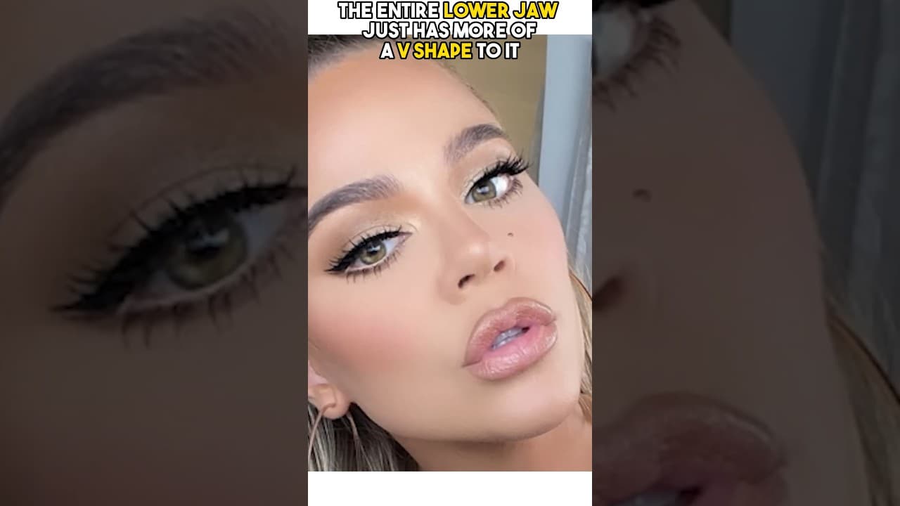 Video thumbnail about kardashian's plastic surgery before and after